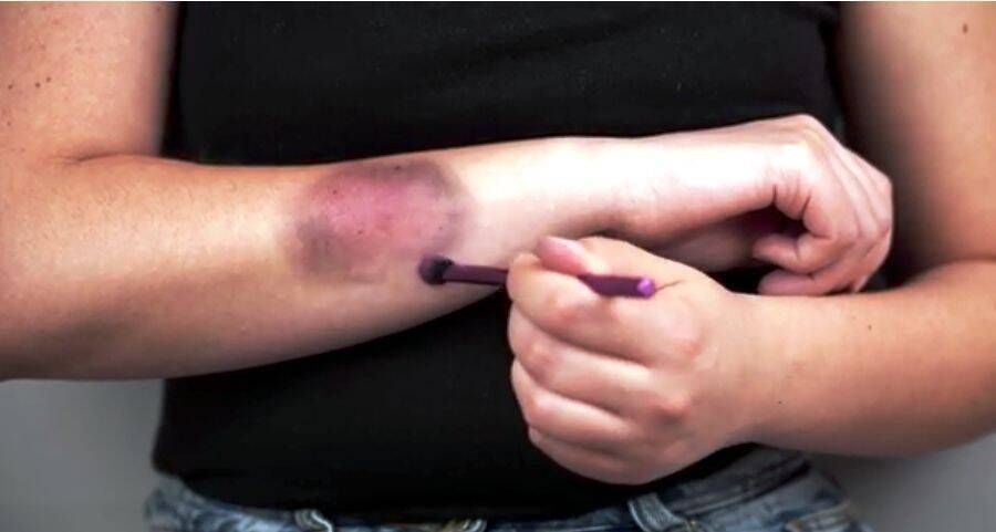 FALSAS DENÚNCIAS DE AGRESSÃO E A IMPORTÂNCIA DA ANÁLISE PERICIAL