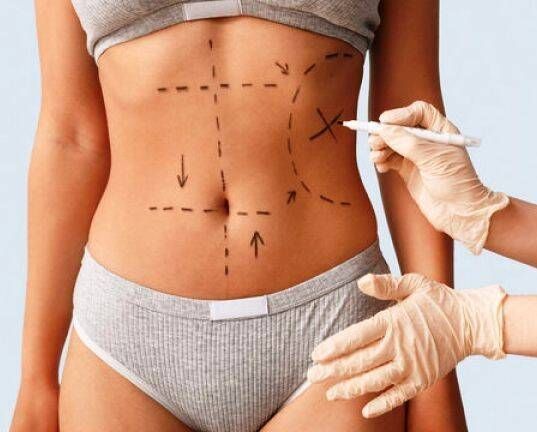 O MÉDICO PERITO E O MÉDICO ASSISTENTE TÉCNICO JUDICIAL EM CASOS DE CIRURGIA PLÁSTICA