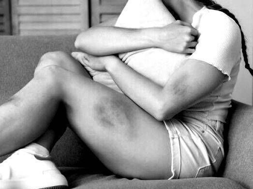 O QUE FAZ UM MÉDICO PERITO ESPECIALIZADO EM LESÕES CORPORAIS E AGRESSÕES FÍSICAS?