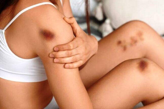 POR QUE CONTRATAR MÉDICO PERITO PARA ANÁLISE DE EXAME DE CORPO DE DELITO?