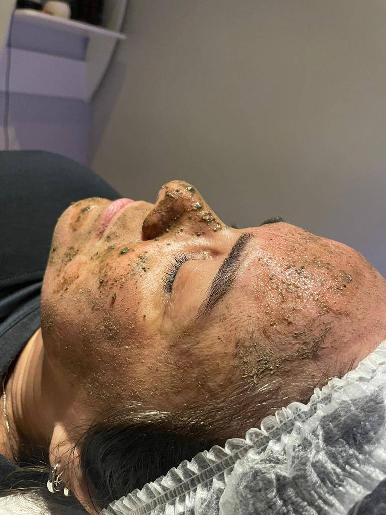 Peeling Herbal - Foto 1