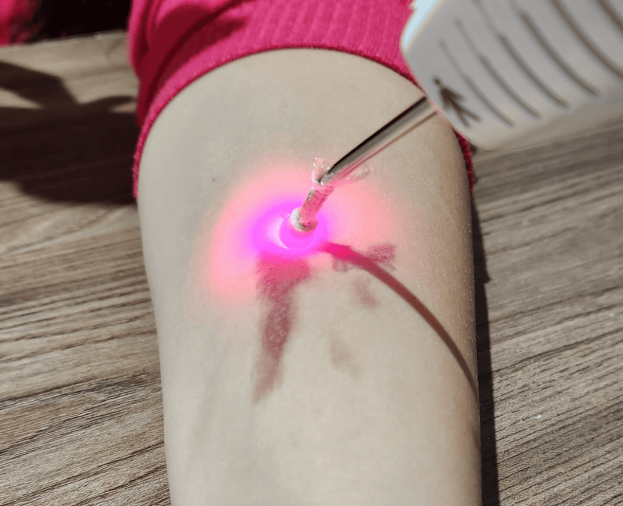Laserterapia - Foto 1