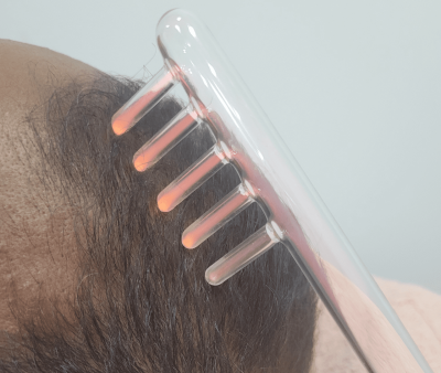 Alta Frequência - Foto 1