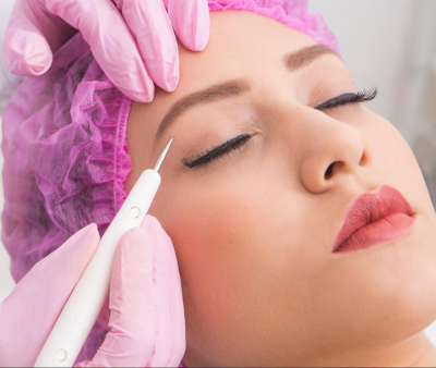 Jato de Plasma - Foto 1