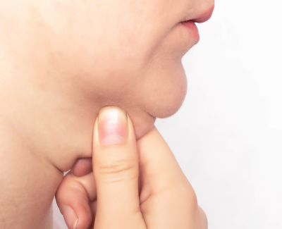 Lipo de Papada (sem corte) - Foto 1