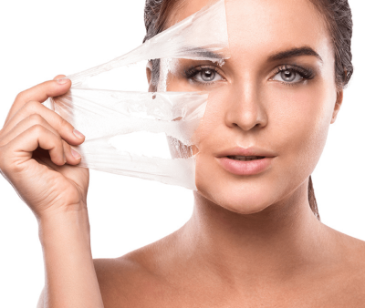 Peeling Químico - Foto 1