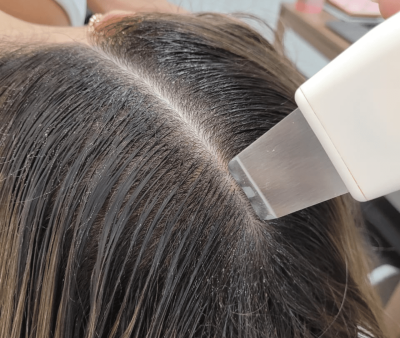 Peeling Ultrassônico - Foto 1