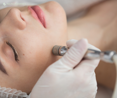 Peeling de Diamante - Foto 1