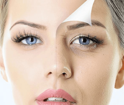 Rejuvenescimento Facial - Foto 1