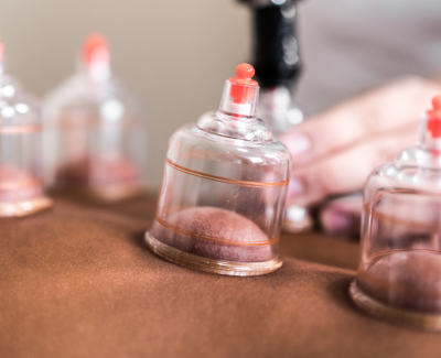 Ventosaterapia - Foto 1