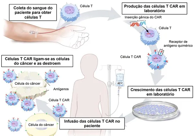 Aprovação CAR-T Cell no Brasil