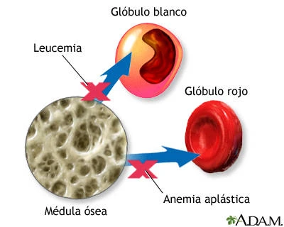 Aspirado Medular - Foto 1