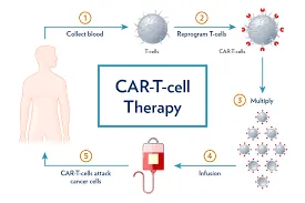 CAR-T Cell - Foto 1