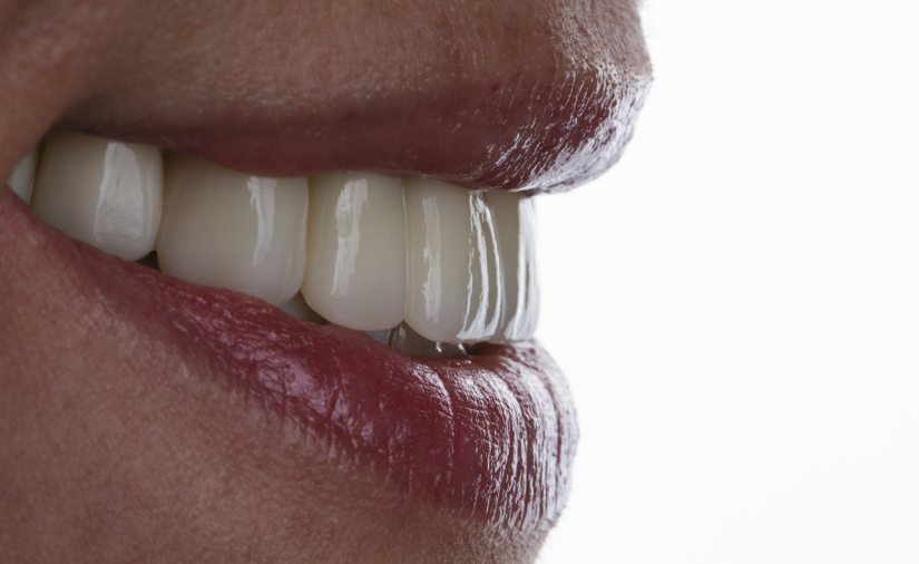 Prótese Dentária - Foto 1