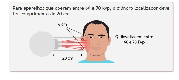 Cilindro Localizador - Foto 2