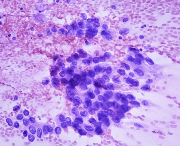 Exames de Anatomia Patológica - Foto 1