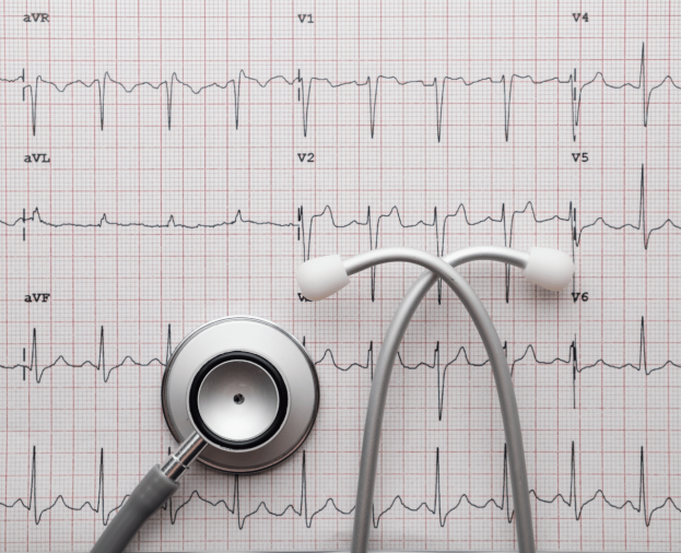 Eletrocardiograma - Foto 1