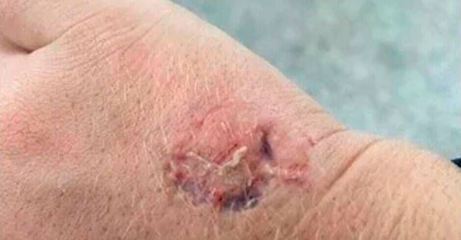 passa amaciante nas partes íntimas e morde policial em shopping