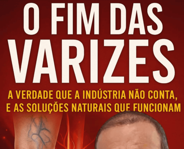 O fim das Varizes - Foto 1