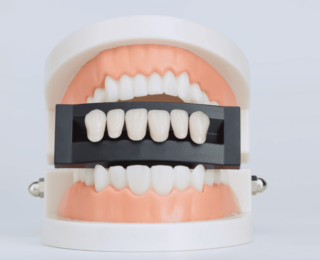 Facetas e Lentes de Contato Dental - Foto 1