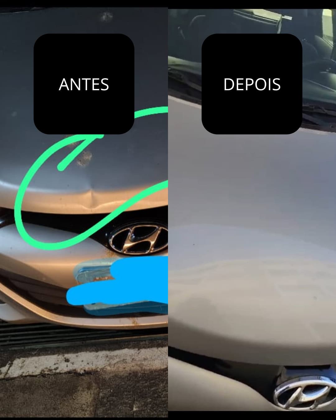 Amassado Hyundai capo PRATA