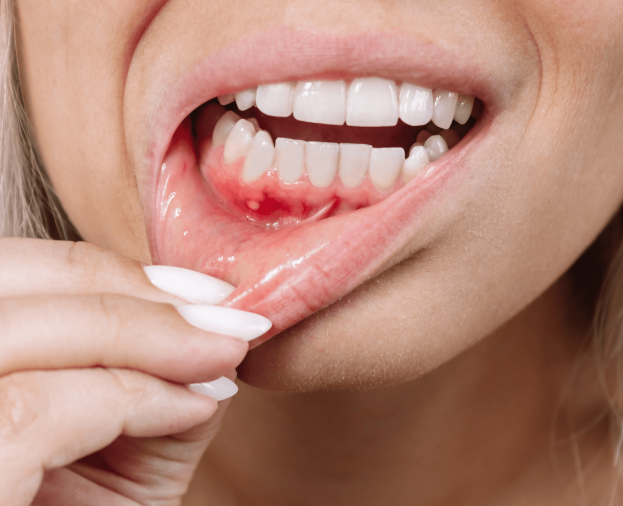 Especialização em Periodontia - Foto 1