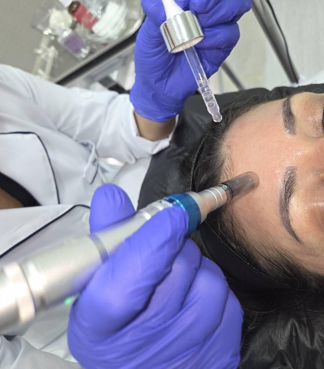 Microagulhamento e Drug Delivery