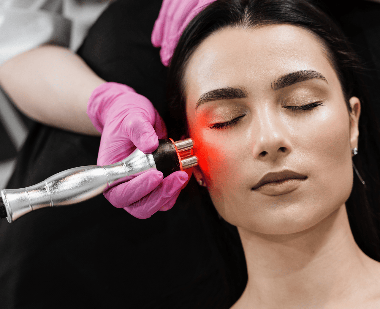 Radiofrequência - Foto 1