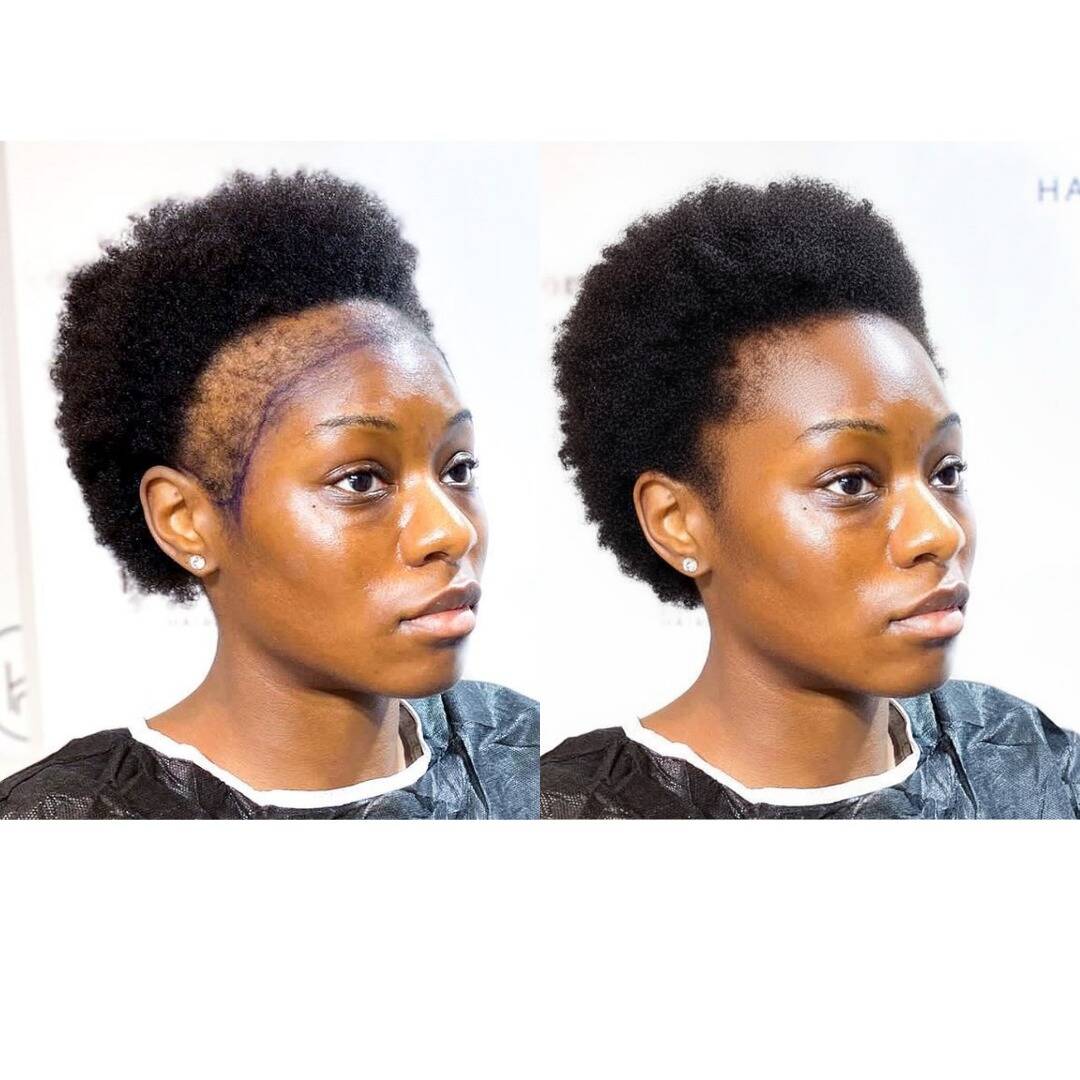 TRATAMENTOS CAPILAR - Foto 1