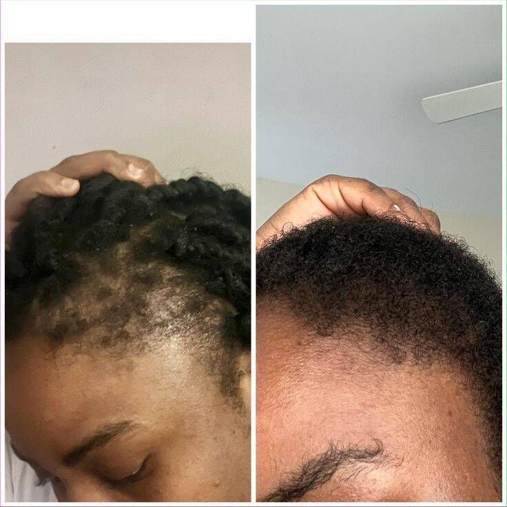 TRATAMENTOS CAPILAR - Foto 3