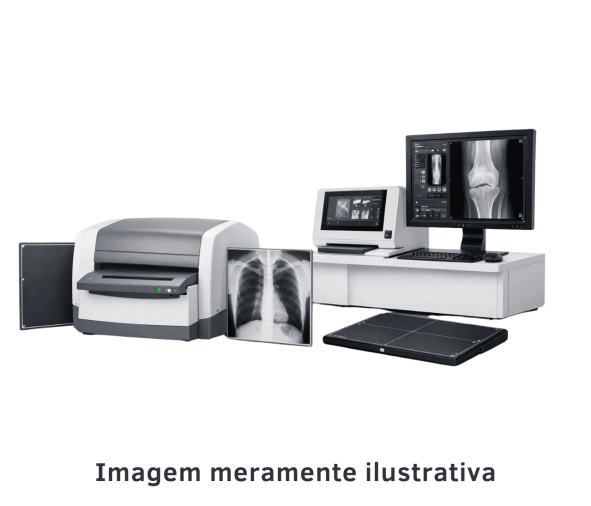 Digitalizadores CR e DR - Foto 1